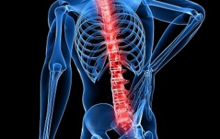 Entender el dolor de espalda